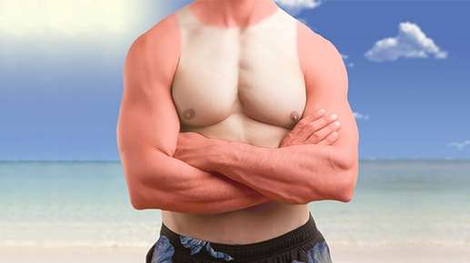 Image of a man's chest with a tank top, sunburn.