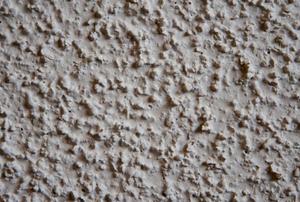 A popcorn-ceiling background.