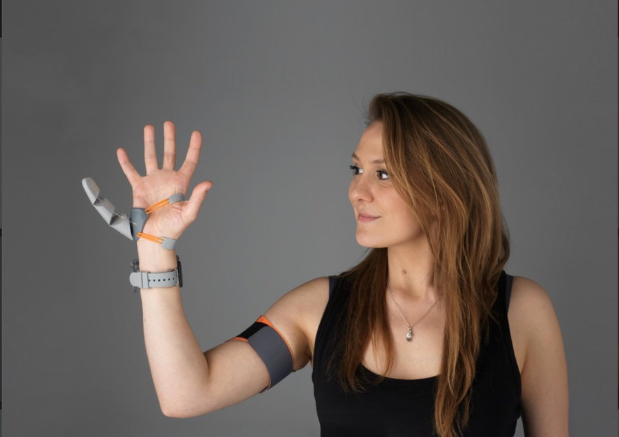 Young woman models th 3d printed, customizable Third Thumb prosthetic.