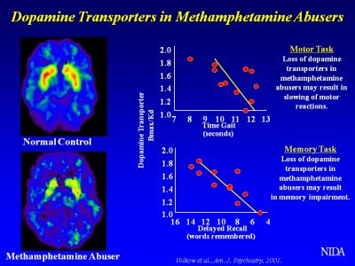 Dopamine Transporters in Methamphetamine Abusers