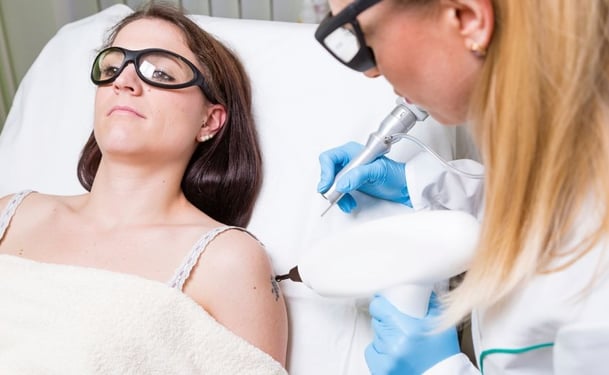 PicoSure: The Evolution of Laser Tattoo Removal