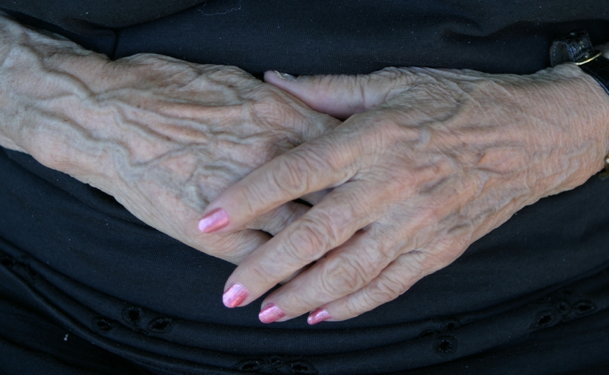 Image result for poor circulation in hands veins