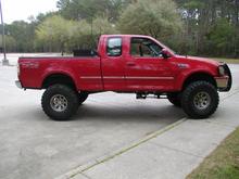 before Body Lift