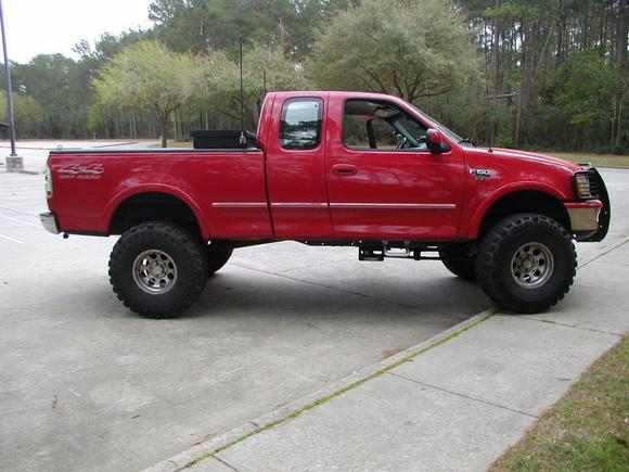 before Body Lift