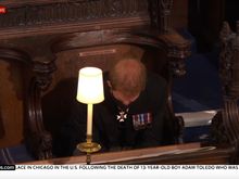 He is bald too.  