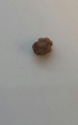 EDI stone