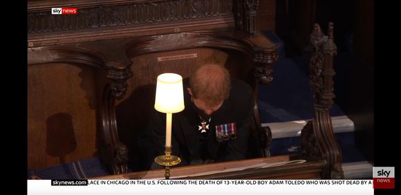 He is bald too.  