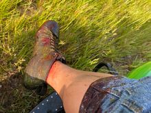 Calf swelled up immediately from smashing in the air cleaner. 