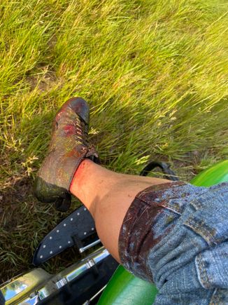 Calf swelled up immediately from smashing in the air cleaner. 