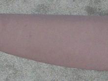 Top panel old covering