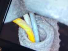 Fuel rail sensor 