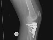 Dean Knee 1.jpg